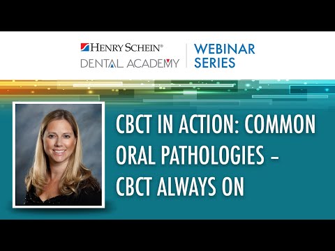 CBCT in Action: Common Oral Pathologies