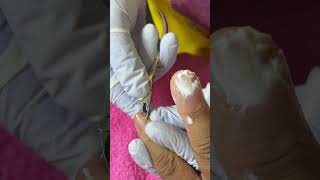 Ep_8292 Fingernails skin removal 👣 พี่ค้าขาย..ทำไมไม่ควรตัดเล็บแบบนี้คะ 😄 (clip from Thailand)