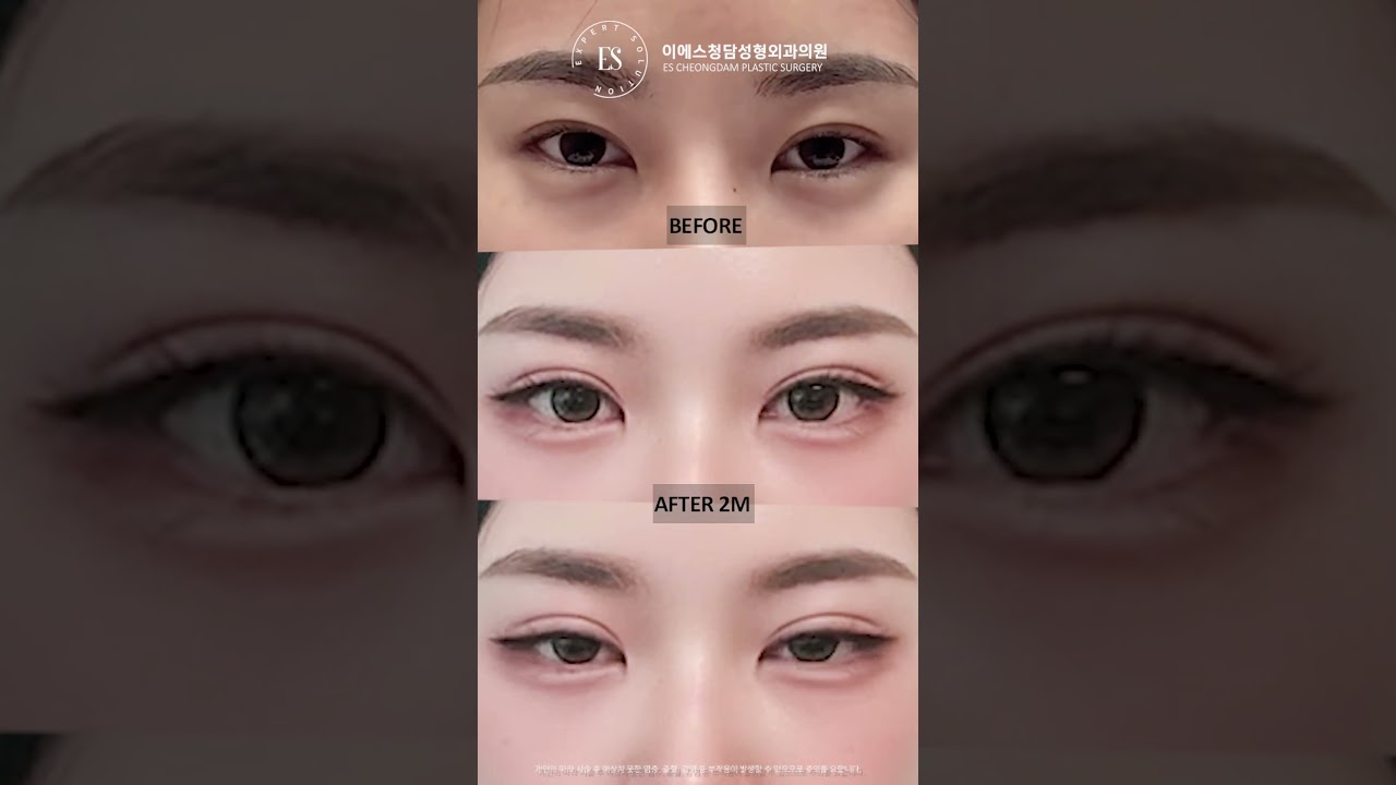이에스 유튜브