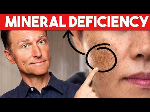 The #1 Deficiency Behind Aging Spots