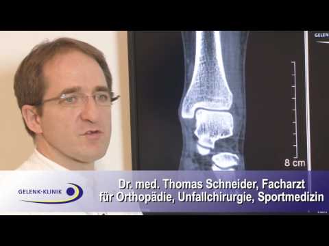 Funktionelle Gruppe von Muskeln liefert Bewegung im Schultergelenk Herniation der Bandscheiben der Lendenwirbelsäule Behandlung Injektionen