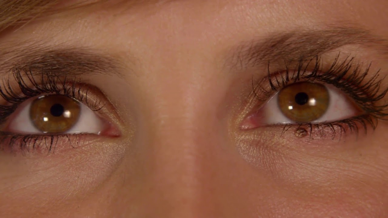 Watch Qué causa la pérdida repentina de la visión Now Qué causa la pérdida repentina de la visión