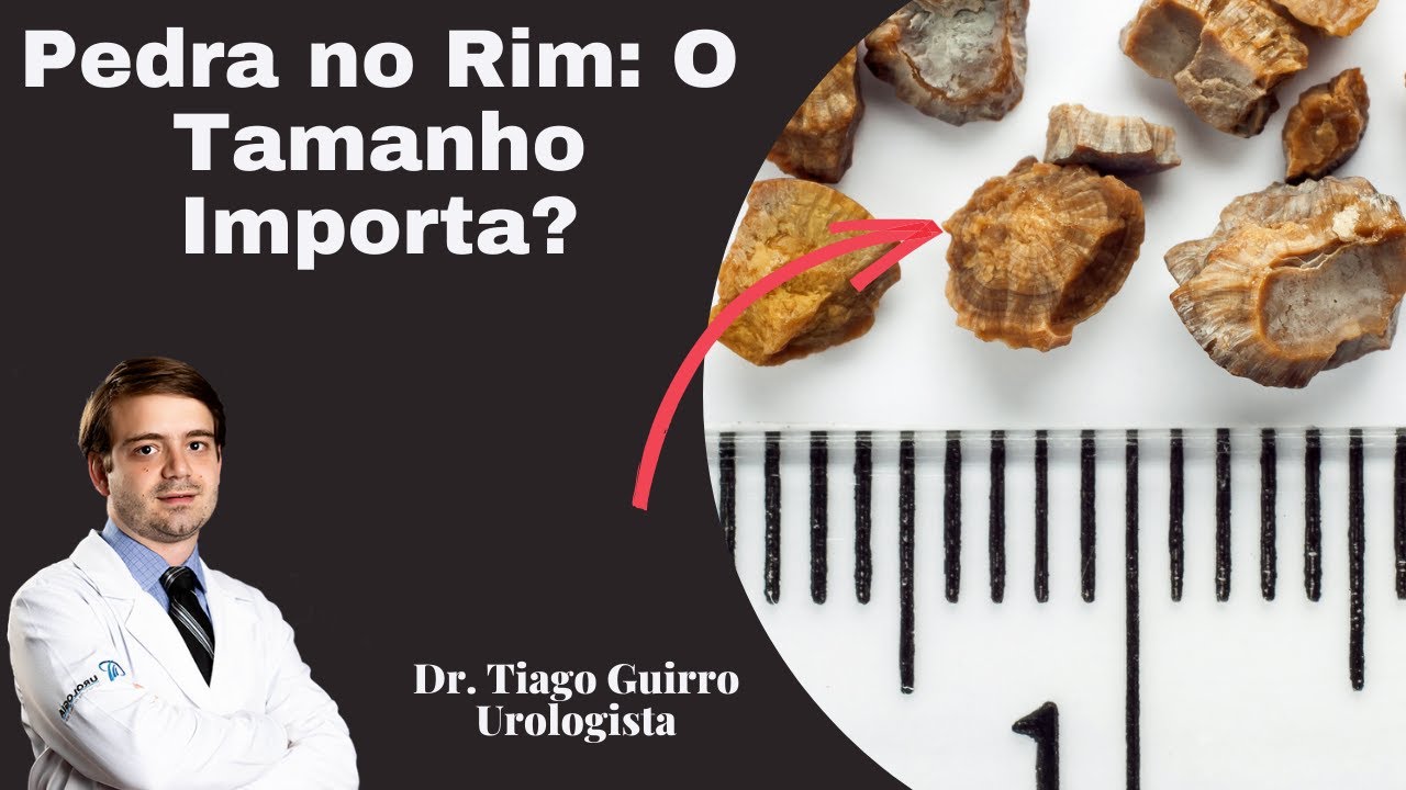 Pedra no Rim: O Tamanho Importa