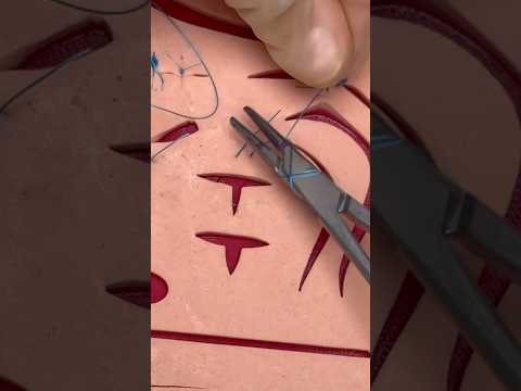 Stitching T-Shaped Wounds 😷 #goodtoknow #surgeonlife #suturing #funfacts #woundcare #lifehacks