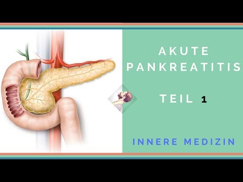 Sie Ihre Gelenke schmerzen von Diabetes Was sind die Arten von Diabetes