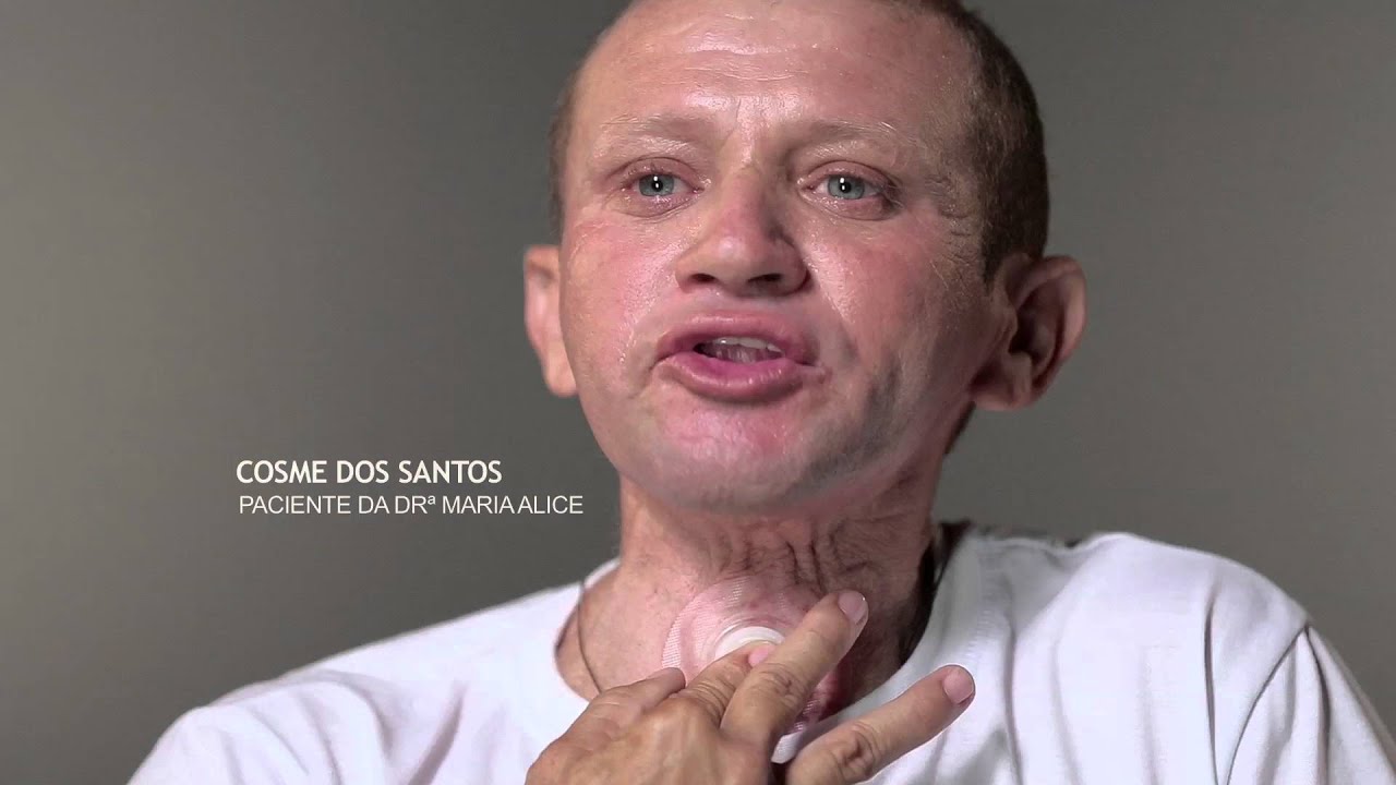 Dia do Fono 2015   Maria Alice e Cosme