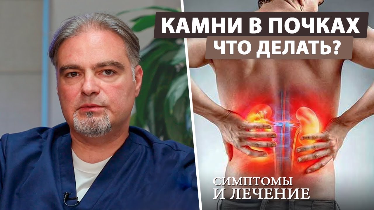 Мочекаменная болезнь – скрытая опасность (камни в почках)