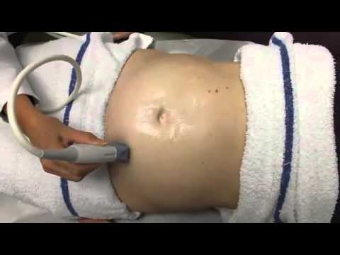 Ultrasound in Obstetrics & Gynecology: A Practical Approach - Clip 10.7