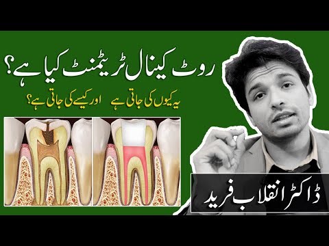 What is Root Canal Treatment | Why & How is it done | Dr. Inqalab Fareed | Urdu | Hindi