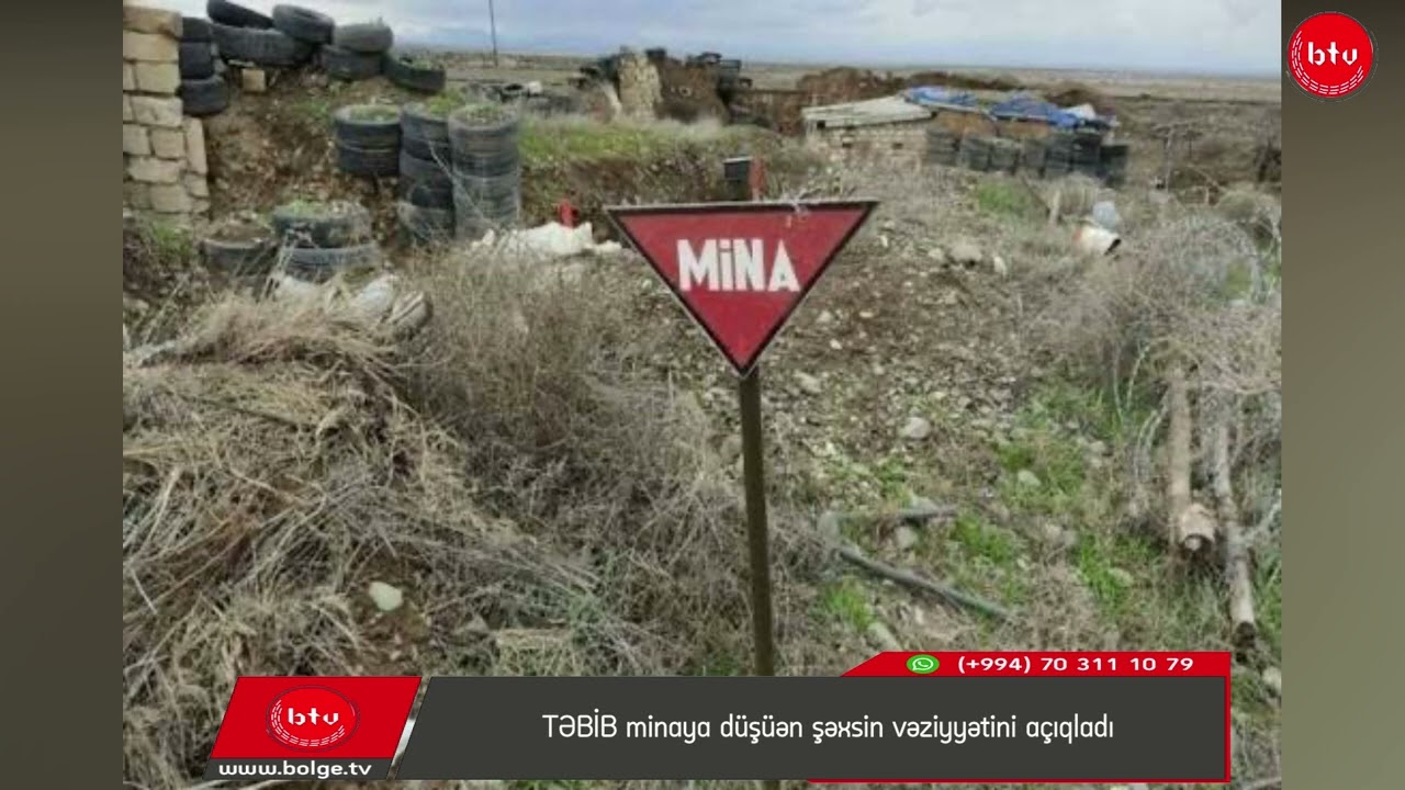 TƏBİB minaya düşüən şəxsin vəziyyətini açıqladı