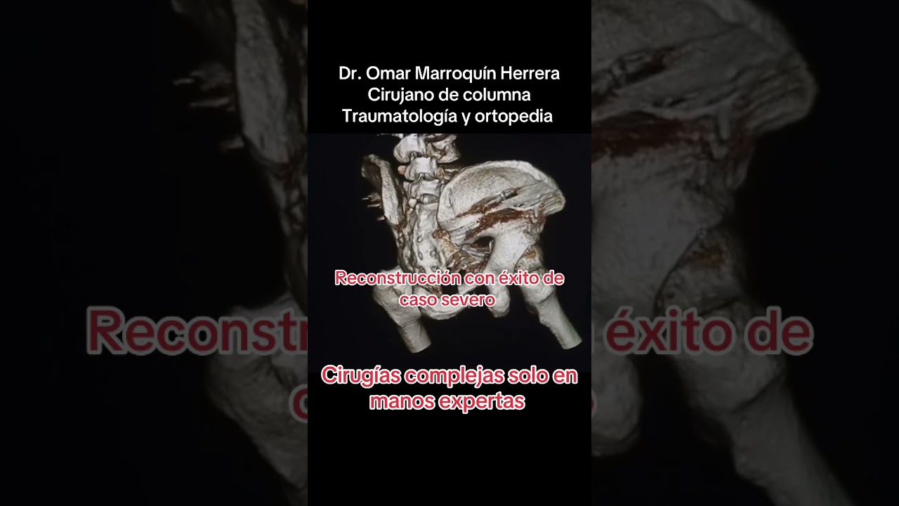 Omar Marroquín Herrera-93