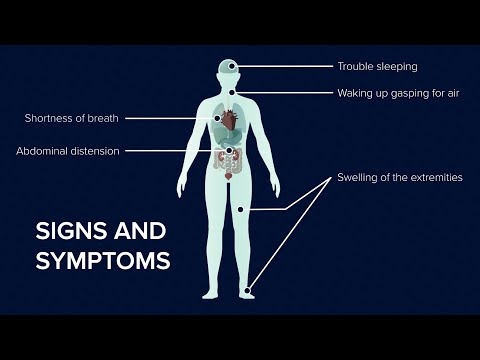 What is Heart Failure? Causes, Symptoms and Treatment | UC Davis Health