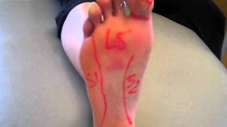 Foot Nerve Pain: Can it come from your Low Back?