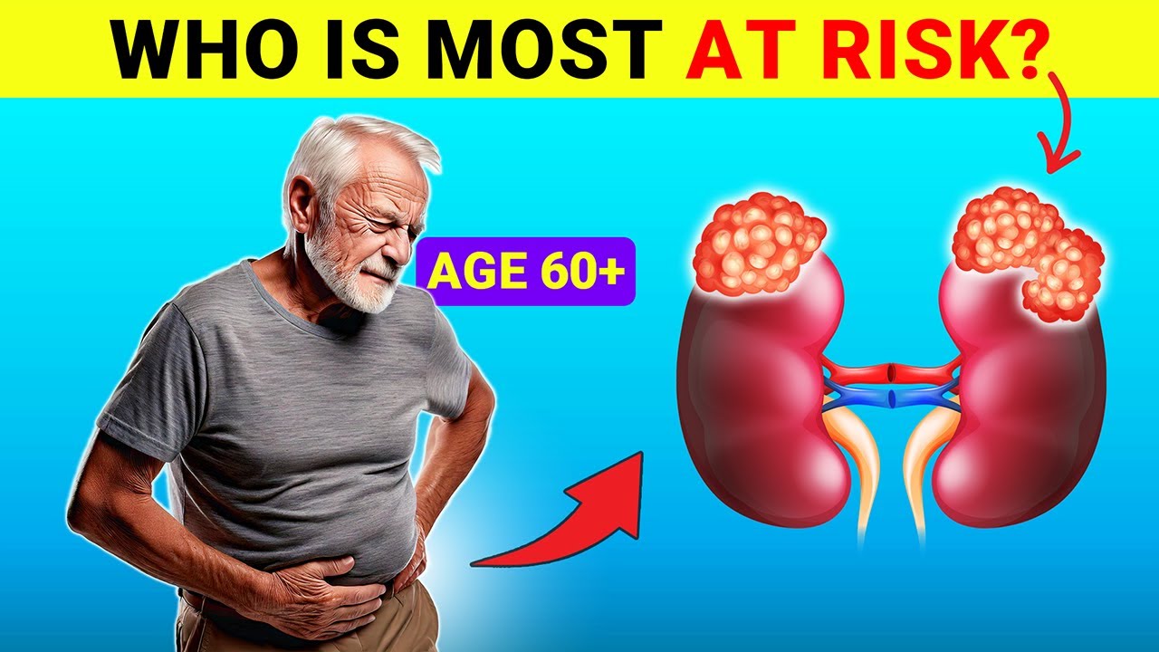 Who Is Most at Risk for Kidney Disease? 10 Most Vulnerable Groups