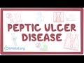 Peptic ulcer disease - causes, symptoms, diagnosis, treatment, pathology