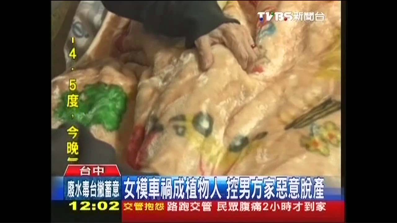 24歲就癱瘓 可愛女模控男友脫產不賠