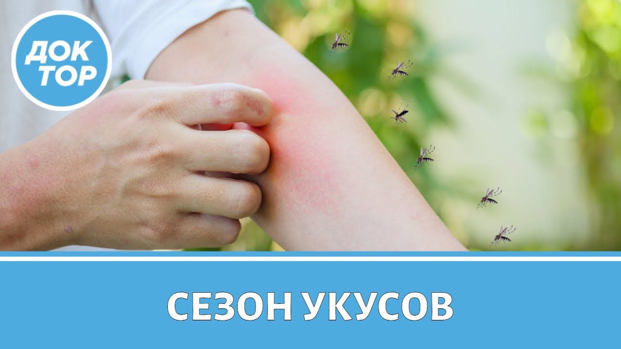 Как не стать едой для комаров, клещей и змей