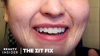 Tightening Face Mask Claims To Retexturize And Firm Skin As It Dries | The Zit Fix | Beauty Insider