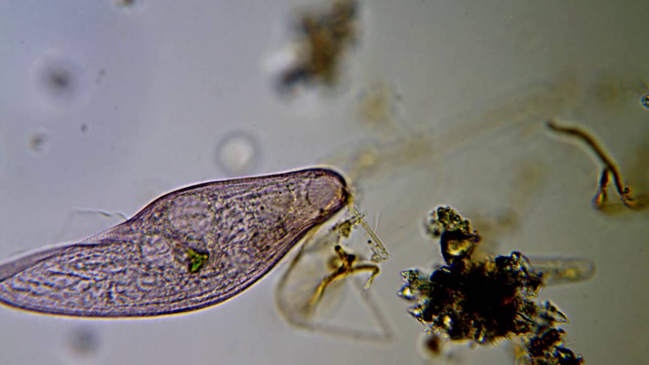 <em>Blepharisma americanum</em>, with a euglenid inside its food vacuole