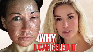Why I Canceled My CO2 Laser Treatment (At 45)
