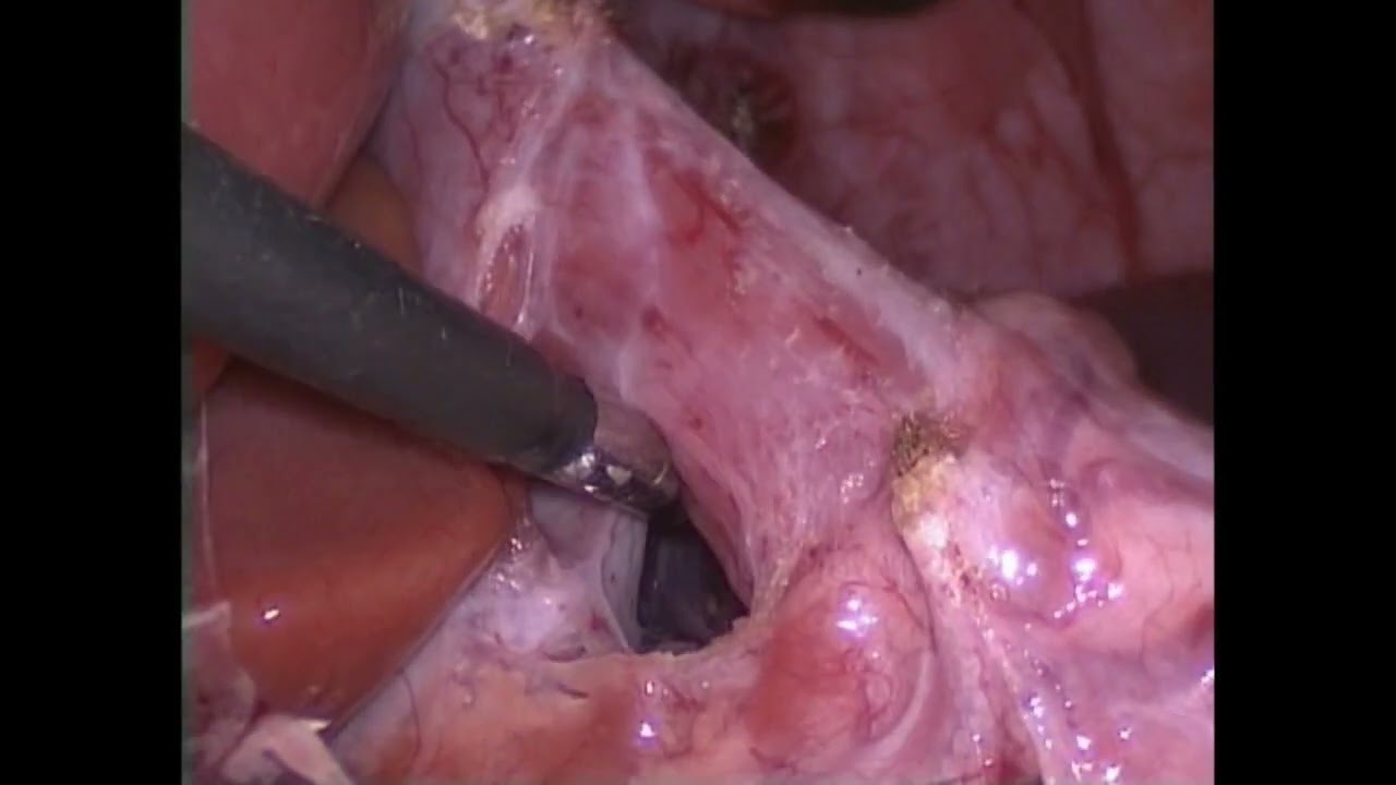 Luis Ricardo García Vázquez-6