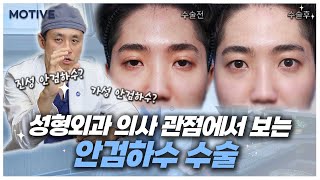 눈매교정의 진실 (feat.안검하수)ㅣ가미성형외과 박건욱 원장