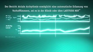 Boston Scientific - Technical animation - ACCOLADE™ - German