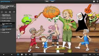 Diffuse Large B Cell Lymphoma