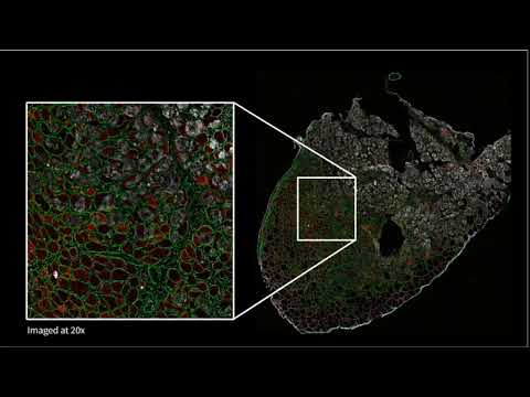 Spatial Proteomic Data with Parallel CITE seq Analysis Elucidates Multiomic Changes with Aging