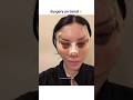 Full Face Surgery Shorts Cosmeticsurgery Beauty