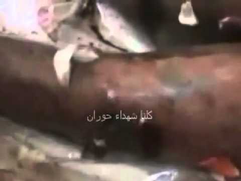 جثمان الطفل (حمزة علي الخطيب) في بلدة الجيزة بمحافظة درعا الذي تعرض للاعتقال من قبل قوات الأمن أثناء مشاركته بمظاهرات "جمعة الغضب" الذي كان يظهر على جثمانه آثار التعذيب الوحشي