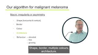 Irregular or asymmetric pigmented lesions