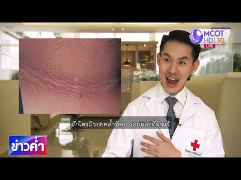 อาการ