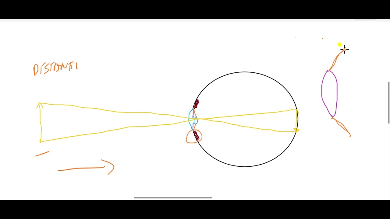 SISTEMA VISUAL 2 ERROS DE REFRAÇÃO E TRÍADE DA ACOMODAÇÃO