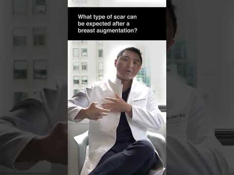 NewBeauty Magazine Interview regarding Breast Augmentation Q & A