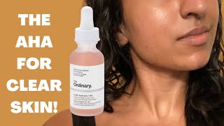 THE ORDINARY LACTIC ACID 10 + HA 2 - EVERYTHING YOU SHOULD KNOW