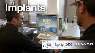 preview picture of video 'Dental Implants Utah | Layton Dentist Kip J Jones, DDS | 801-546-3513'