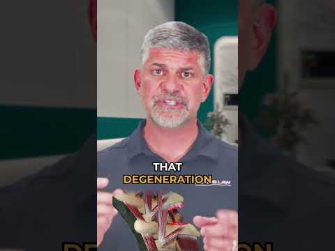 A Complication Of Spinal  Fusion That Every One Should Know About ⚠️#spinalfusion #scoliosis #spine