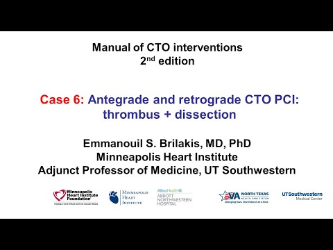 Case 6: Manual of CTO Interventions - OCT for thrombus and dissection