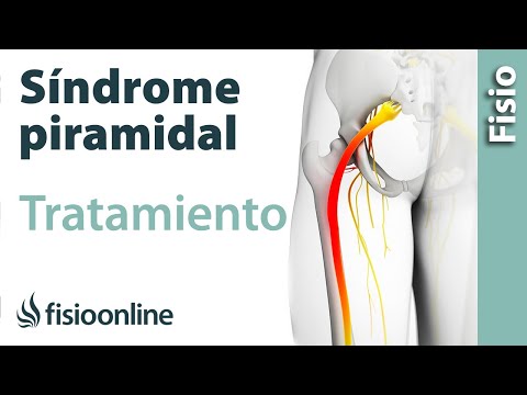 Síndrome del piramidal - Tratamiento con ejercicios, automasajes y estiramientos