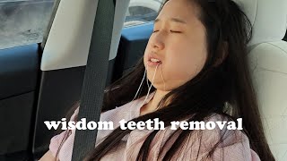 Wisdom Teeth Removal VLOG | Eating Only Soft Foods + Recovery