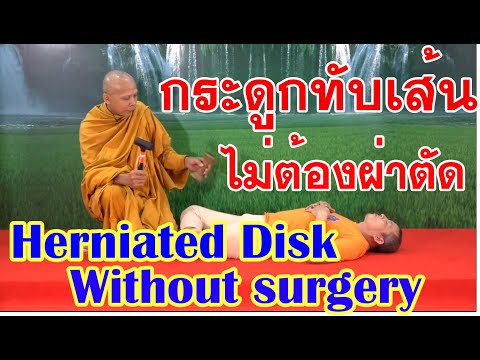 SDA 2 ความอ่อนแอ หญิงเชื้อโรคราคาสเปนบิน