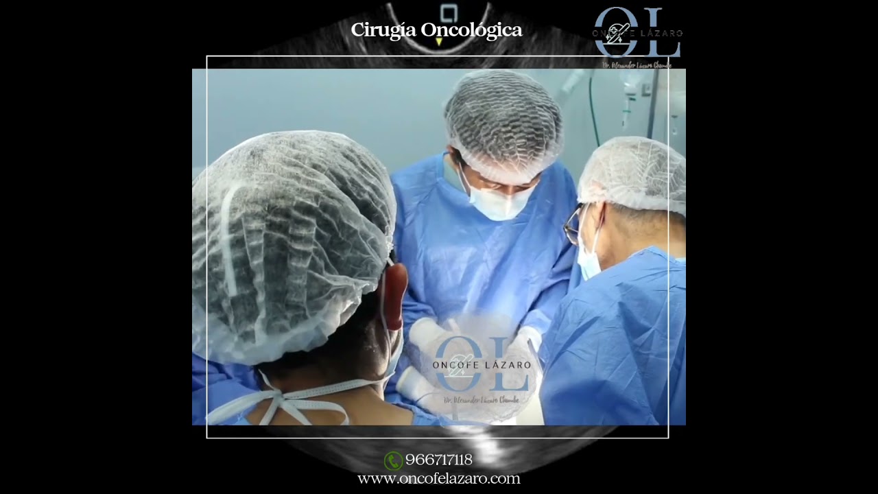 Alexander Alonso Lázaro Chumbe-26