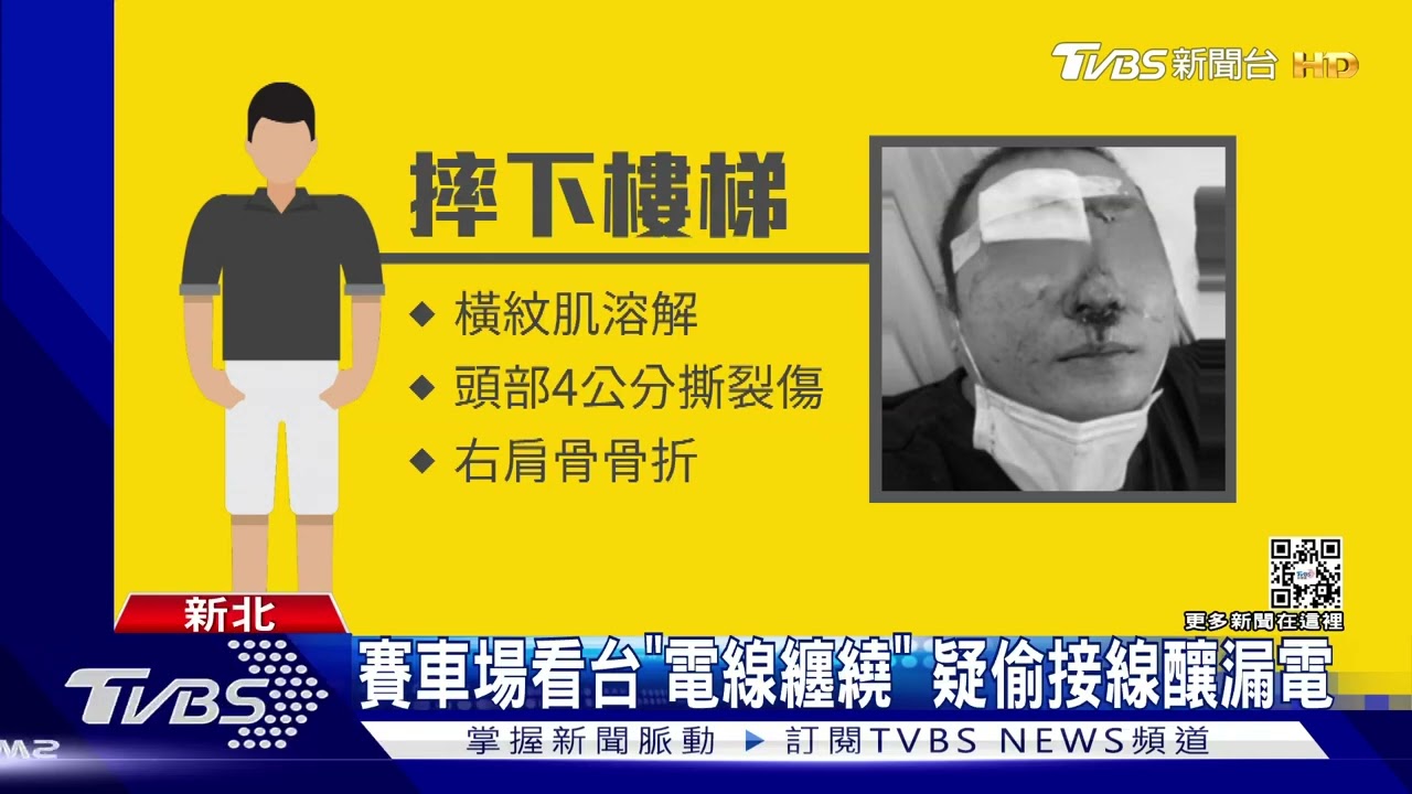 下樓梯突被「吸住」!遭扶手電擊 濺血昏厥