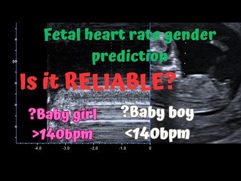 Ultrasound fetal heart rate gender prediction. Is it reliable? How accurate is it? Three Cases