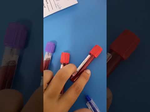 Different vials for cp,CBC,rfts,lfts