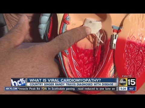 Rally for Red: What is viral cardiomyopathy?