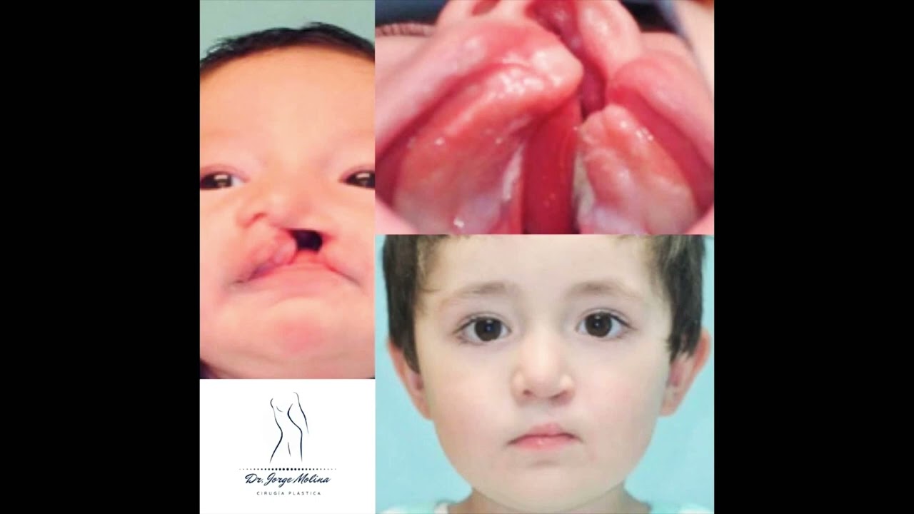 Jorge Eduardo Molina Ortega-16