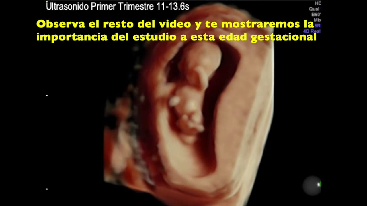 Alfredo Fernández-11