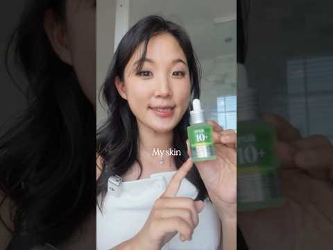 Probé 5 productos de ácido azelaico de k-beauty para que tú no tengas que hacerlo